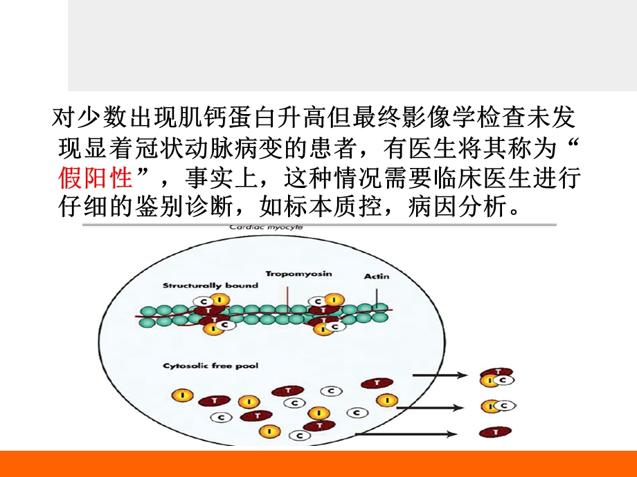 肌钙蛋白升高的鉴别诊断.ppt_第3页