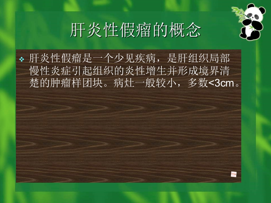 肝炎性假瘤的螺旋CT诊断.ppt_第2页