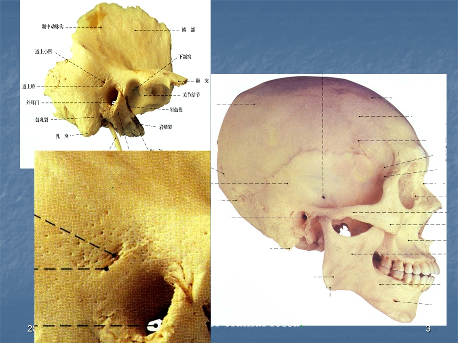 耳及颞骨的应用解剖.ppt_第3页