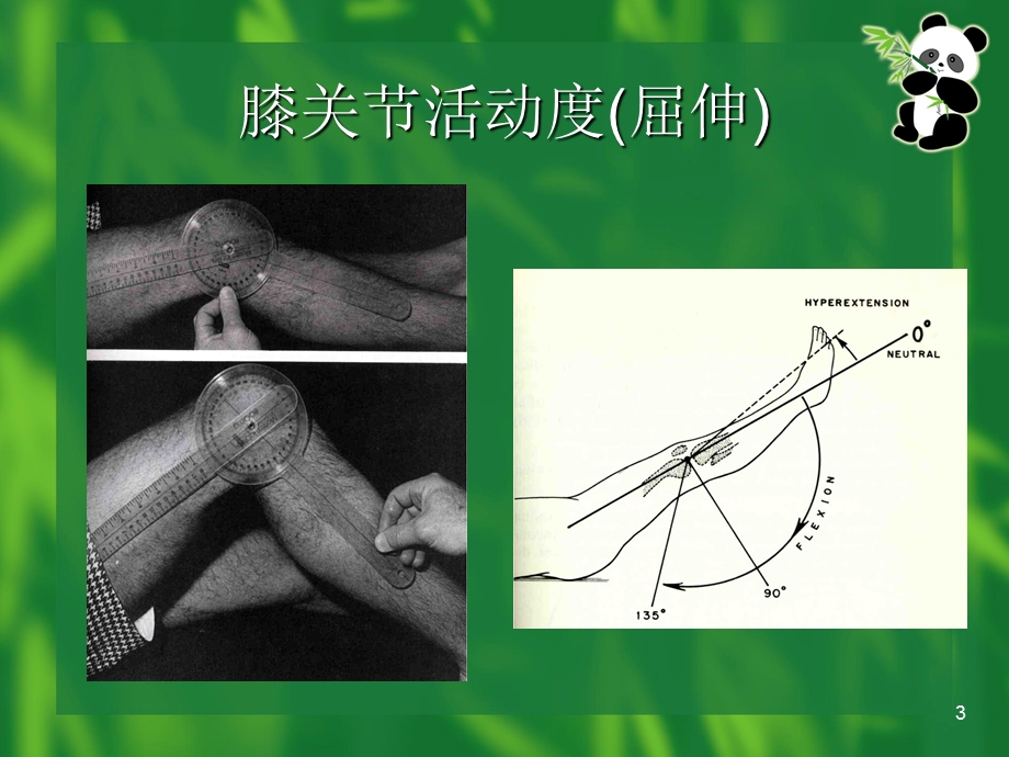 膝关节检查法.ppt_第3页