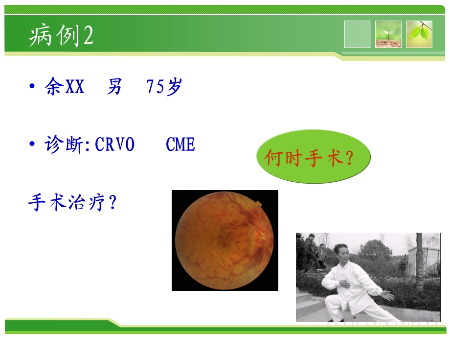 视网膜静脉阻塞.ppt_第3页