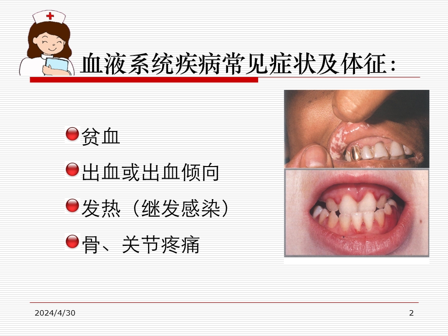 血液科疾病常见症状护理.ppt_第2页