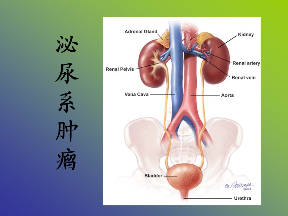 膀胱肿瘤.ppt_第1页