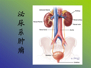 膀胱肿瘤.ppt