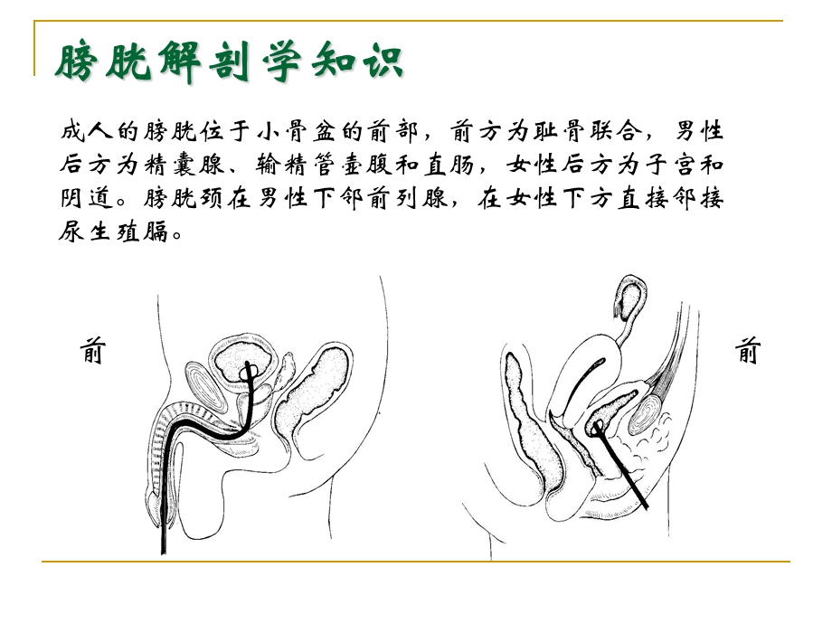 膀胱冲洗.ppt_第3页