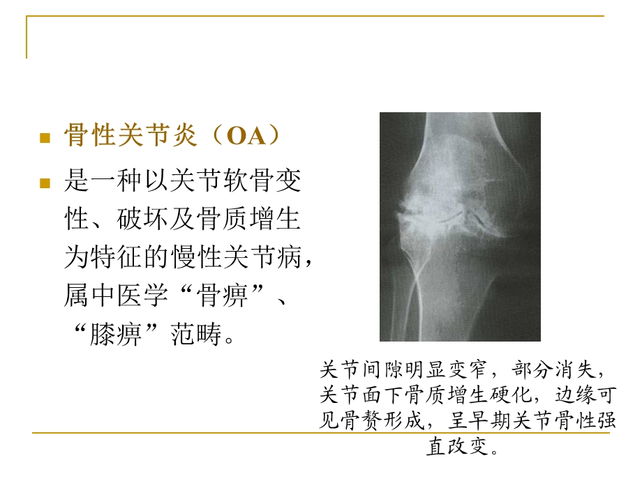 骨关节痹症(骨性关节炎).ppt.ppt_第1页