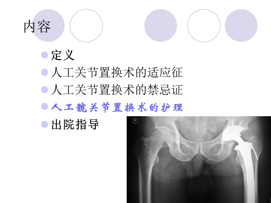 髋关节置换术护理.ppt_第2页