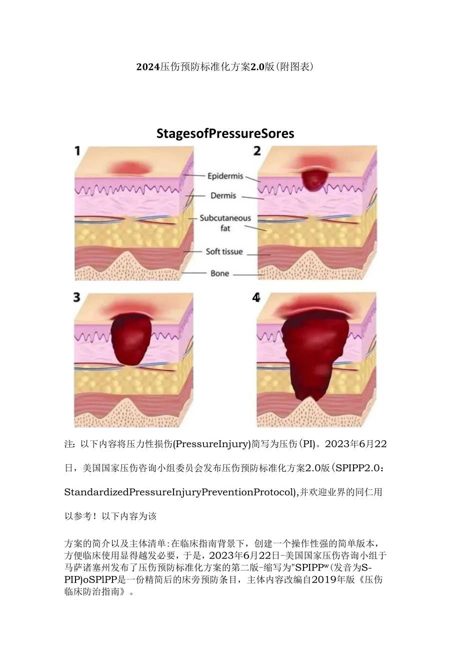 2024压伤预防标准化方案2.0版（附图表）.docx_第1页