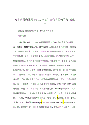 关于银屑病性关节炎合并老年性类风湿关节炎1例报告.docx