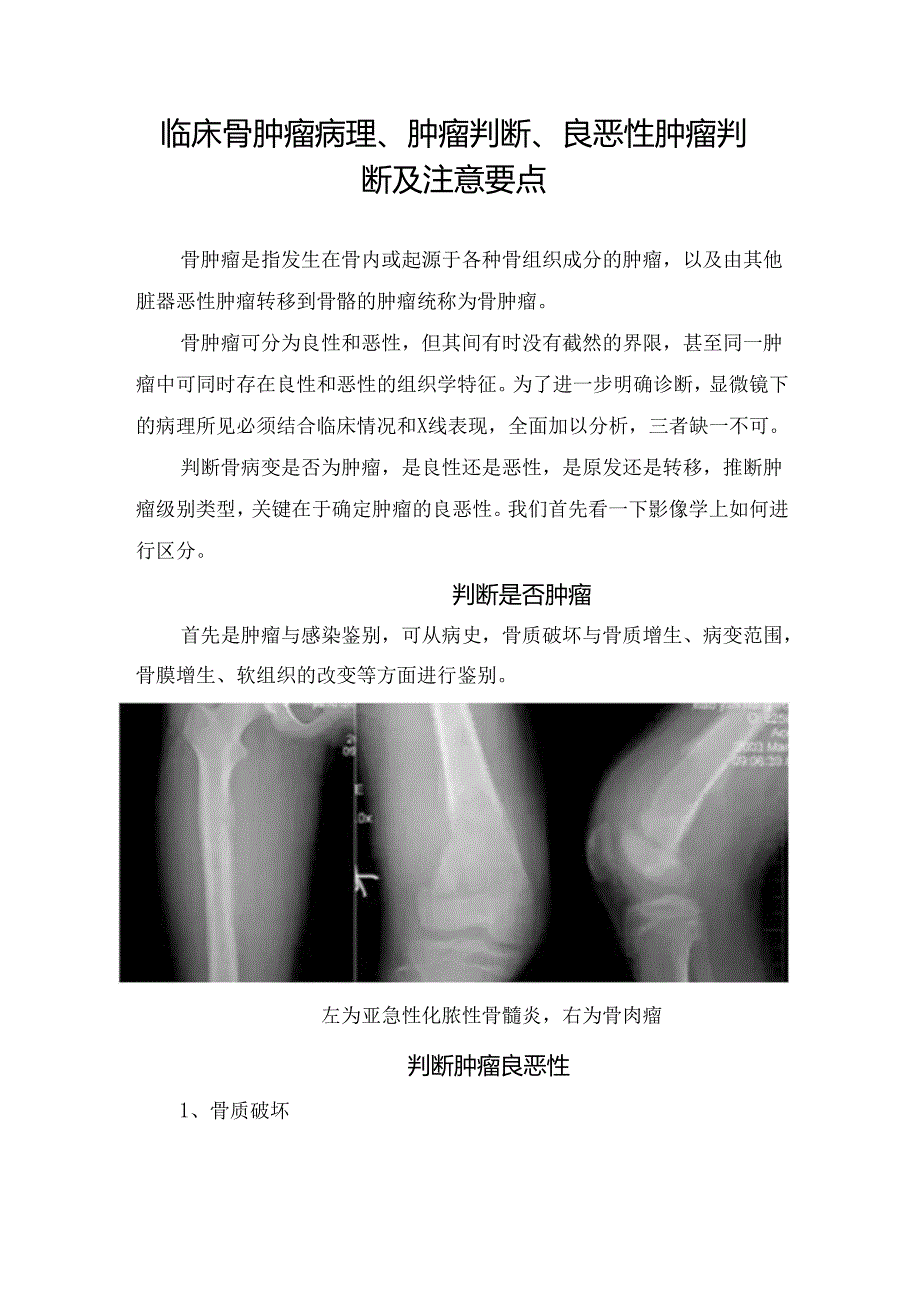 临床骨肿瘤病理、肿瘤判断、良恶性肿瘤判断及注意要点.docx_第1页