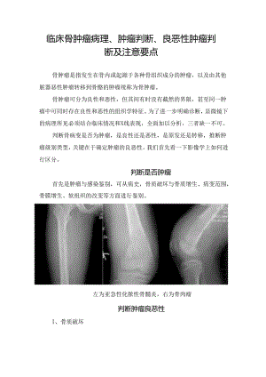 临床骨肿瘤病理、肿瘤判断、良恶性肿瘤判断及注意要点.docx