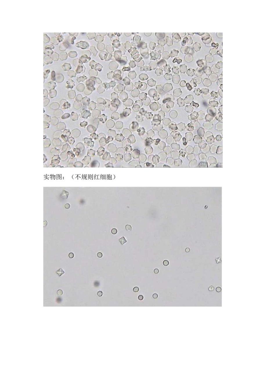 红细胞、白细胞、上皮细胞、管型、其他成分等临床检验项目特征表现.docx_第2页