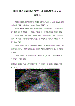 临床胃肠超声检查方式、正常影像表现及回声表现.docx