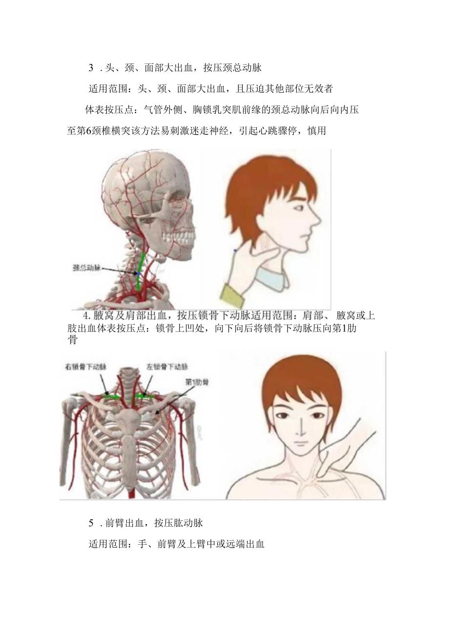 临床头顶部、面部、肩部等部位血管出血压迫点止血法血管分布走行、适用范围及体表按压点.docx_第2页