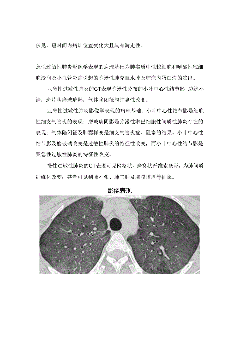 临床过敏性肺炎病理、临床表现、病因、诊断要点及影像表现.docx_第2页