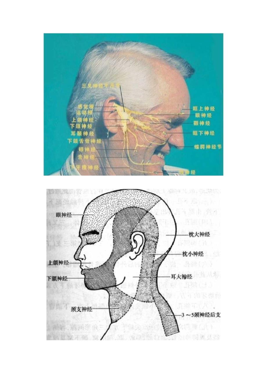 临床三叉神经解剖、病因、疼痛特征、影像学扫描、鉴别诊断及治疗要点.docx_第2页