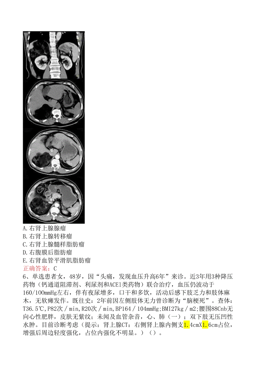 内分泌学(医学高级)：肾上腺疾病测试题五.docx_第2页