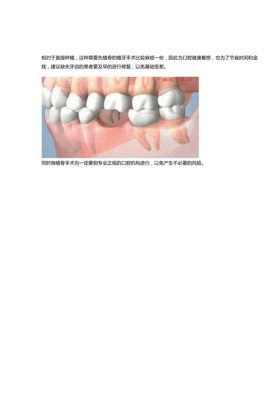 种骨粉流程.docx_第3页