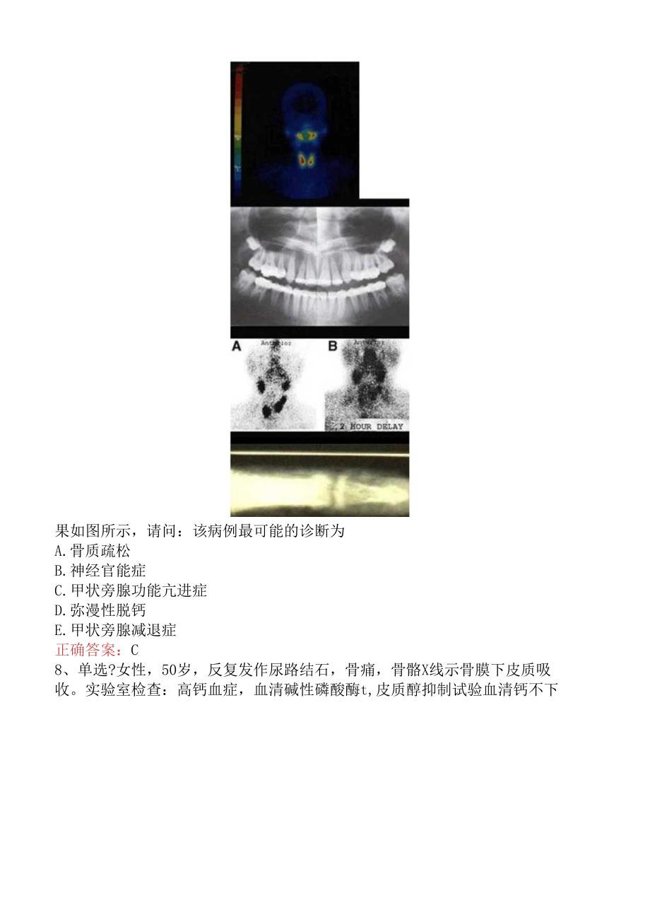 内分泌学(医学高级)：甲状旁腺疾病试题预测（强化练习）.docx_第2页