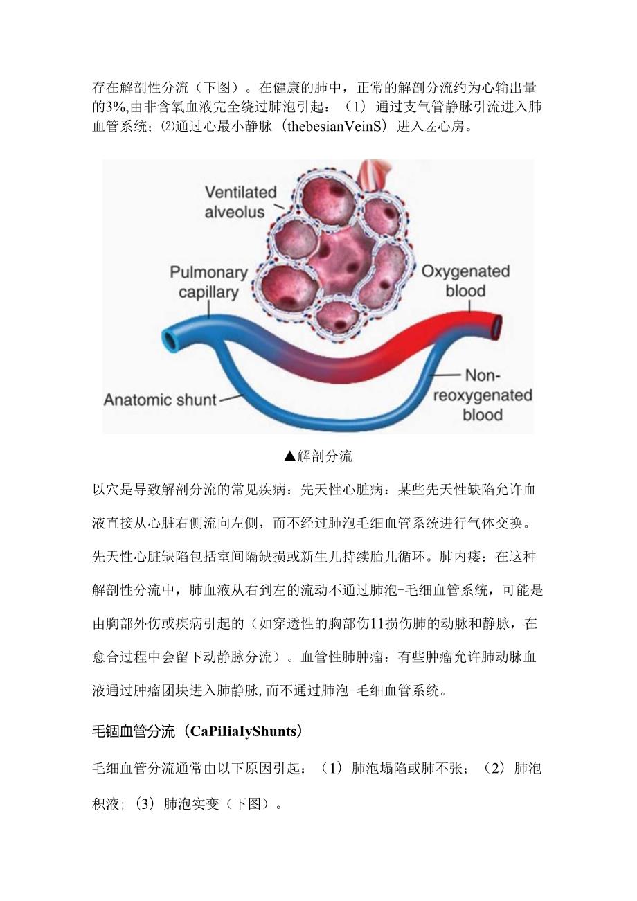 2024肺分流知识科普（附图表）.docx_第2页