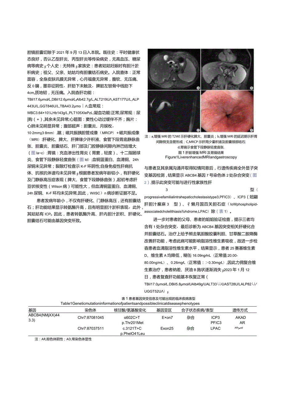 ATP结合盒亚家族B成员4（ABCB4）基因突变相关性肝硬化合并胆囊结石1例报告.docx_第2页