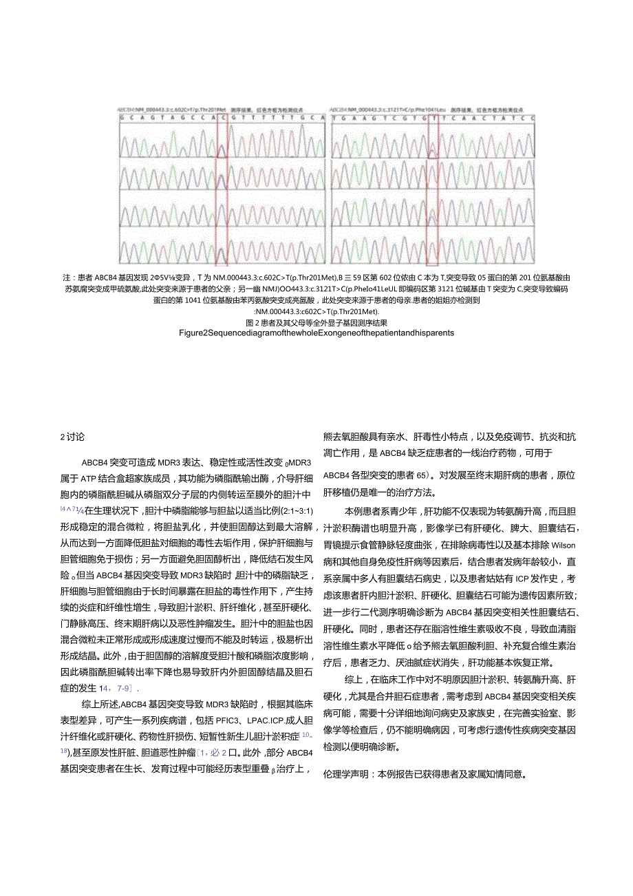 ATP结合盒亚家族B成员4（ABCB4）基因突变相关性肝硬化合并胆囊结石1例报告.docx_第3页