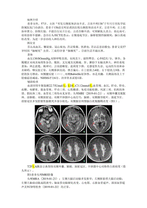 伴皮质下梗死和白质脑病的常染色体显性遗传性脑动脉病3例.docx