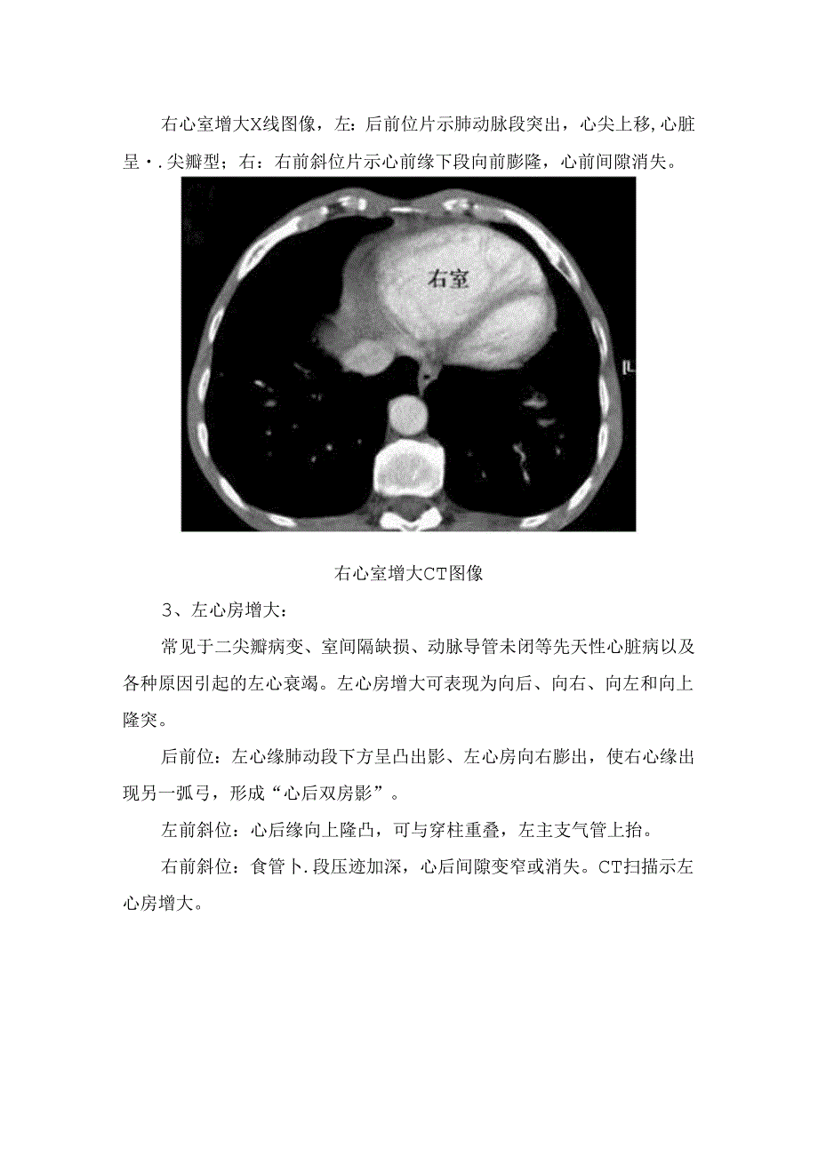 临床心脏增大、心包异常、肺循环异常等循环系统基本病变影像学表现.docx_第1页