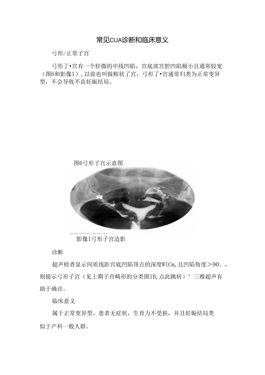 临床常见先天性子宫畸形诊断和意义.docx_第2页