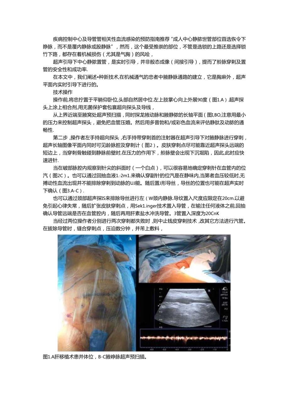 超声引导腋静脉穿刺置管术（超声引导经腋静脉穿刺中心静脉置管临床应用）.docx_第1页