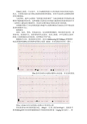 超声心动图排除非ST段抬高型心肌梗死（心脏超声造影诊断非ST段抬高型心肌梗死患者梗死相关血管的应用）.docx