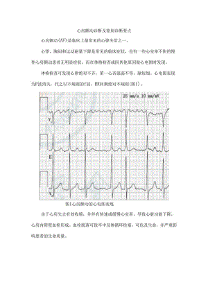 心房颤动诊断及鉴别诊断要点.docx