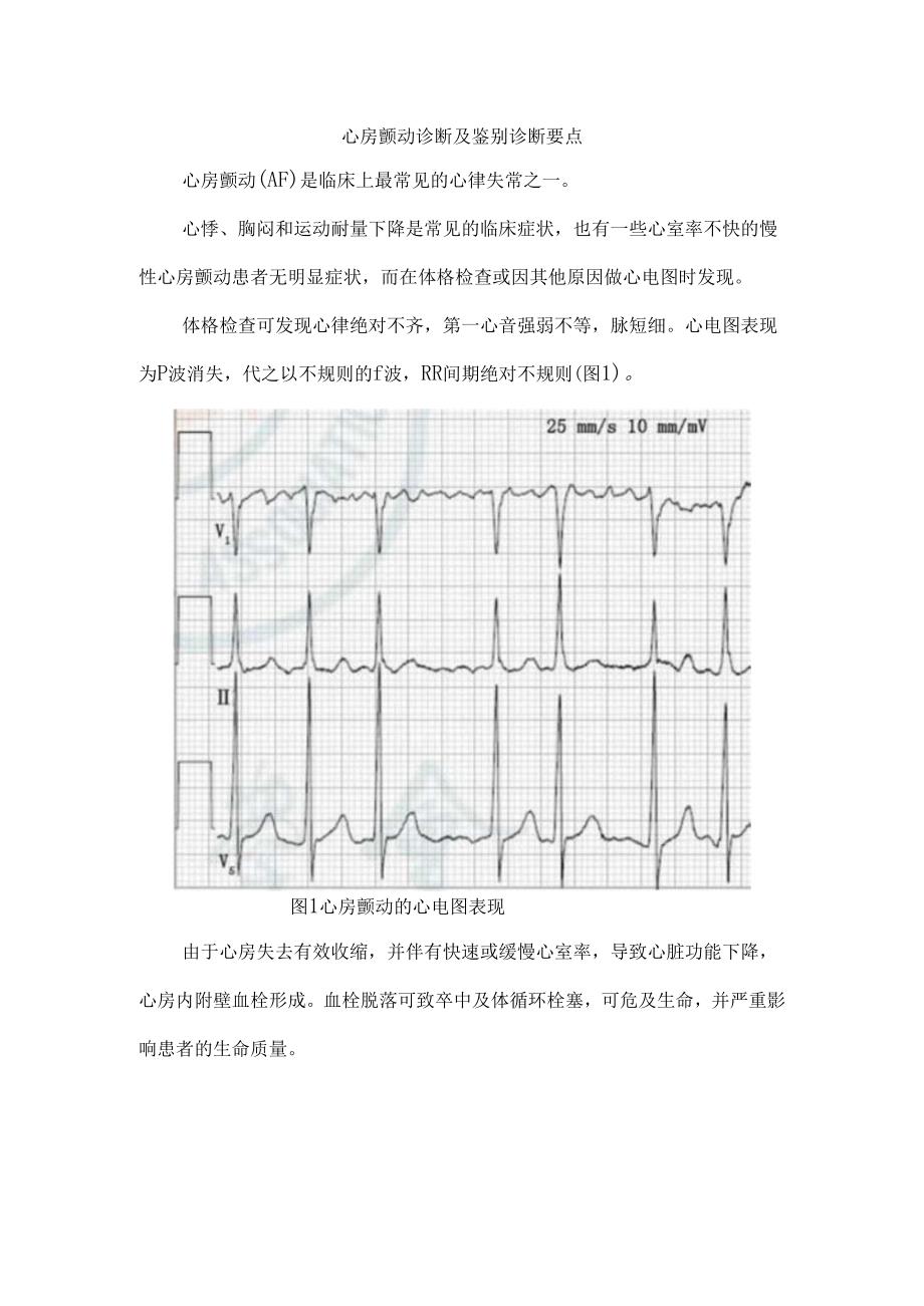 心房颤动诊断及鉴别诊断要点.docx_第1页