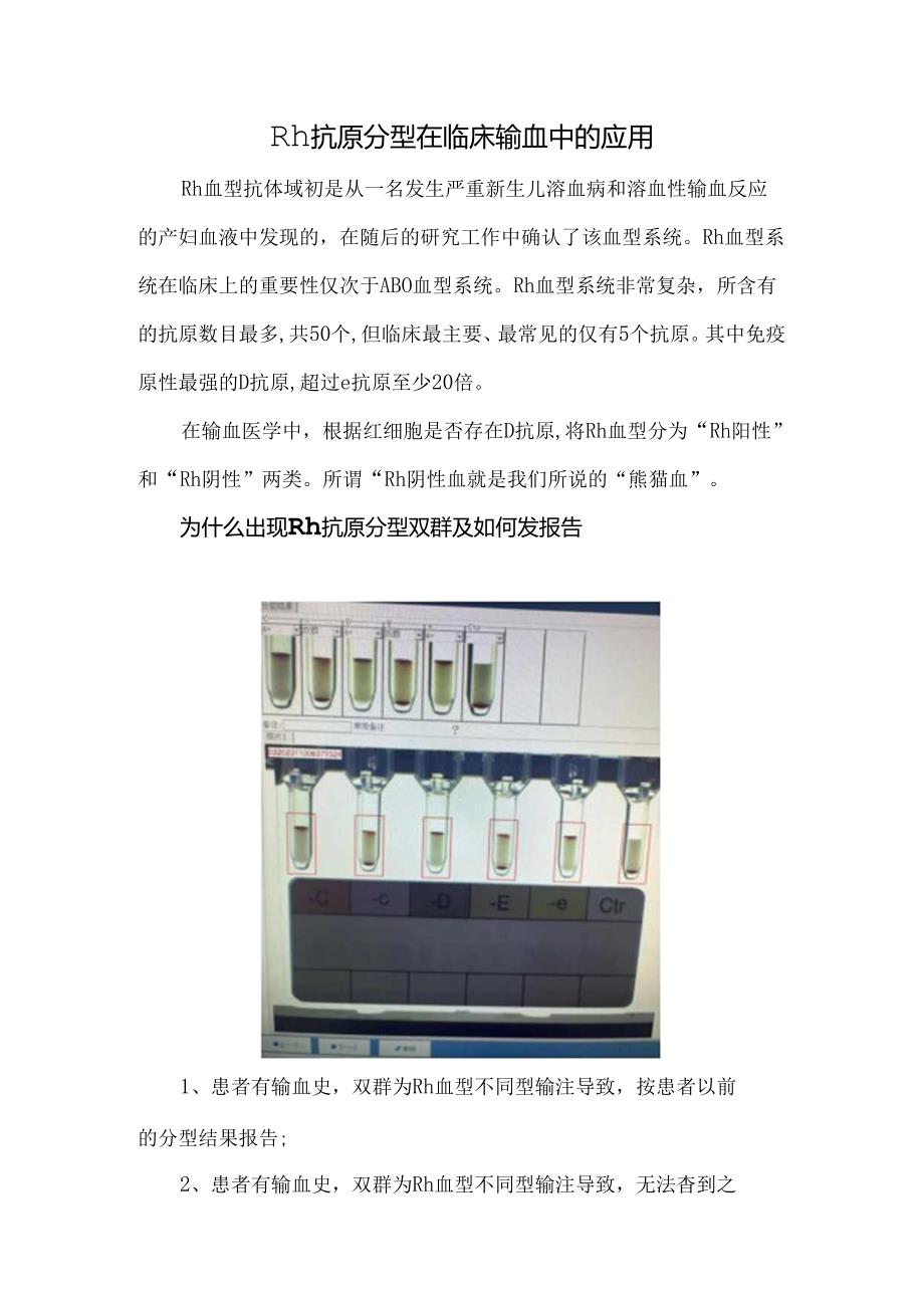 Rh抗原分型在临床输血中的应用.docx_第1页