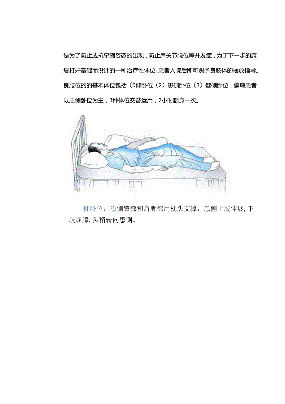 康复早期介入的重要性.docx_第2页